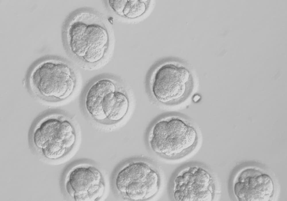 Cloned human embryos
