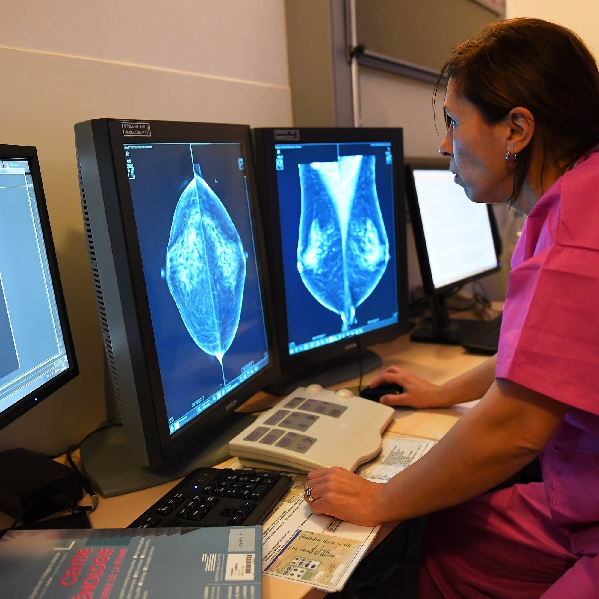 cover of episode Paying out of pocket for breast cancer screenings