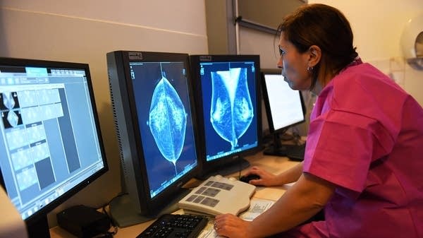 Paying out of pocket for breast cancer screenings