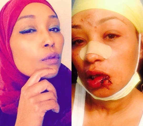 Asma Jama, before and after the attack