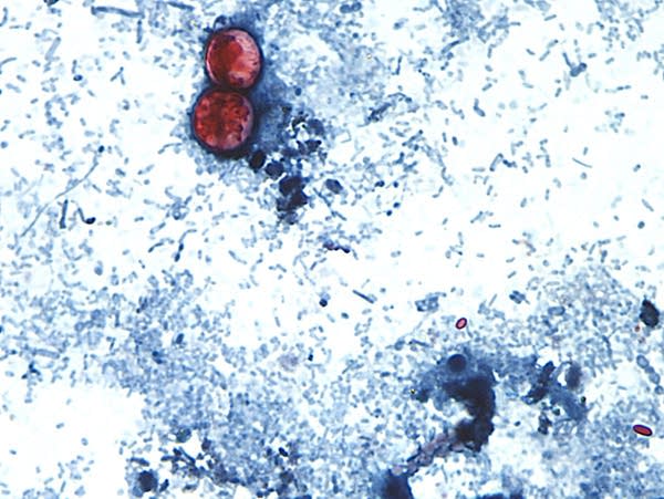 How can Minnesotans protect themselves from foodborne illness