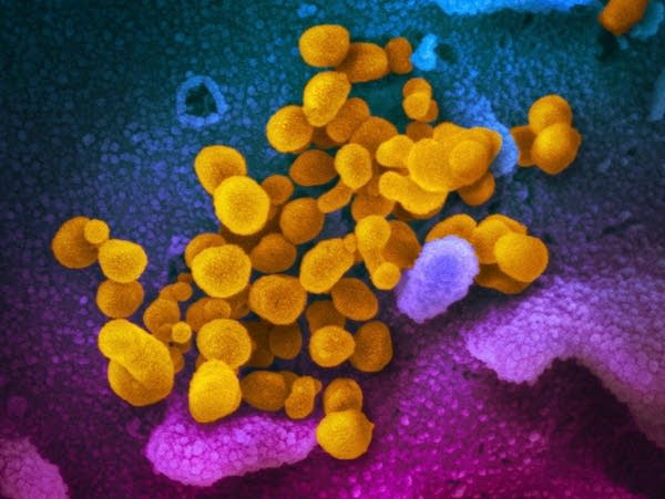 The spread of coronavirus and the state of testing