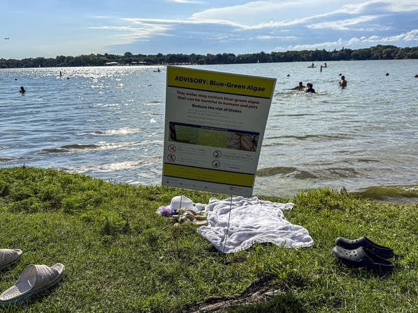 A warning sign about blue-green algae
