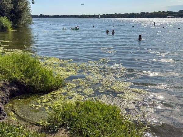 Minnesota beaches are closed due to bacteria, toxic algae. Here's where and what to look for. 