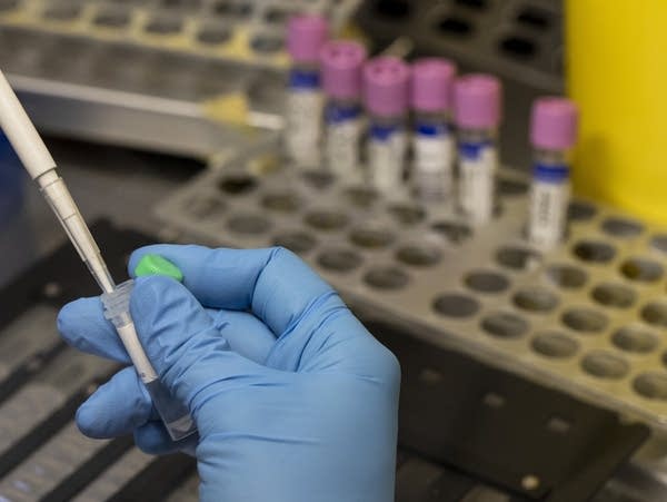 A gloved hand holds a testing tube vial