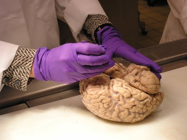 Healthy looking brain