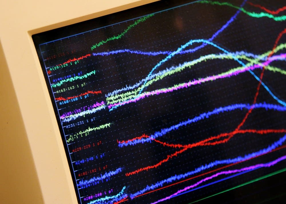 Brain activity