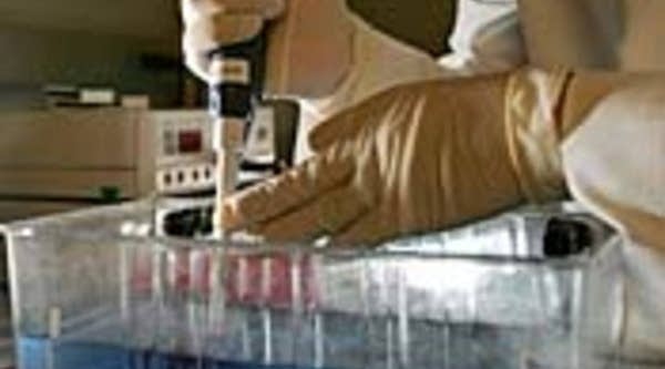 A lab technician loads DNA samples onto a gel while searching for variations in genetic samples that would point to someone's susceptibility to lung, prostate, breast and colo-rectal cancer at the UCSF Comprehensive Cancer Center in San Francisco.