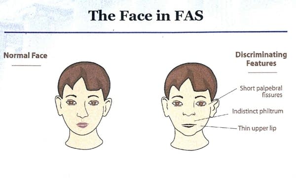 Facial comparison