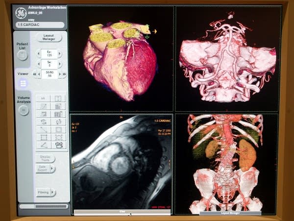 What if sharing your MRI was as simple as Pinterest?