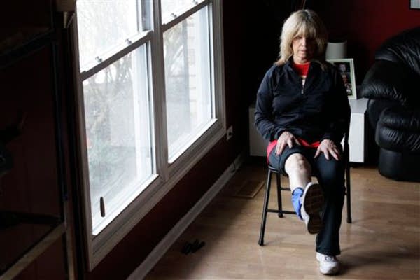 Artificial knee recipient