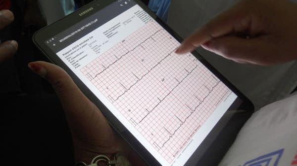 An Ivorian doctor uses a tablet computer in a Bouake hospital's telemedicine departement for heart diseases in 2019. 