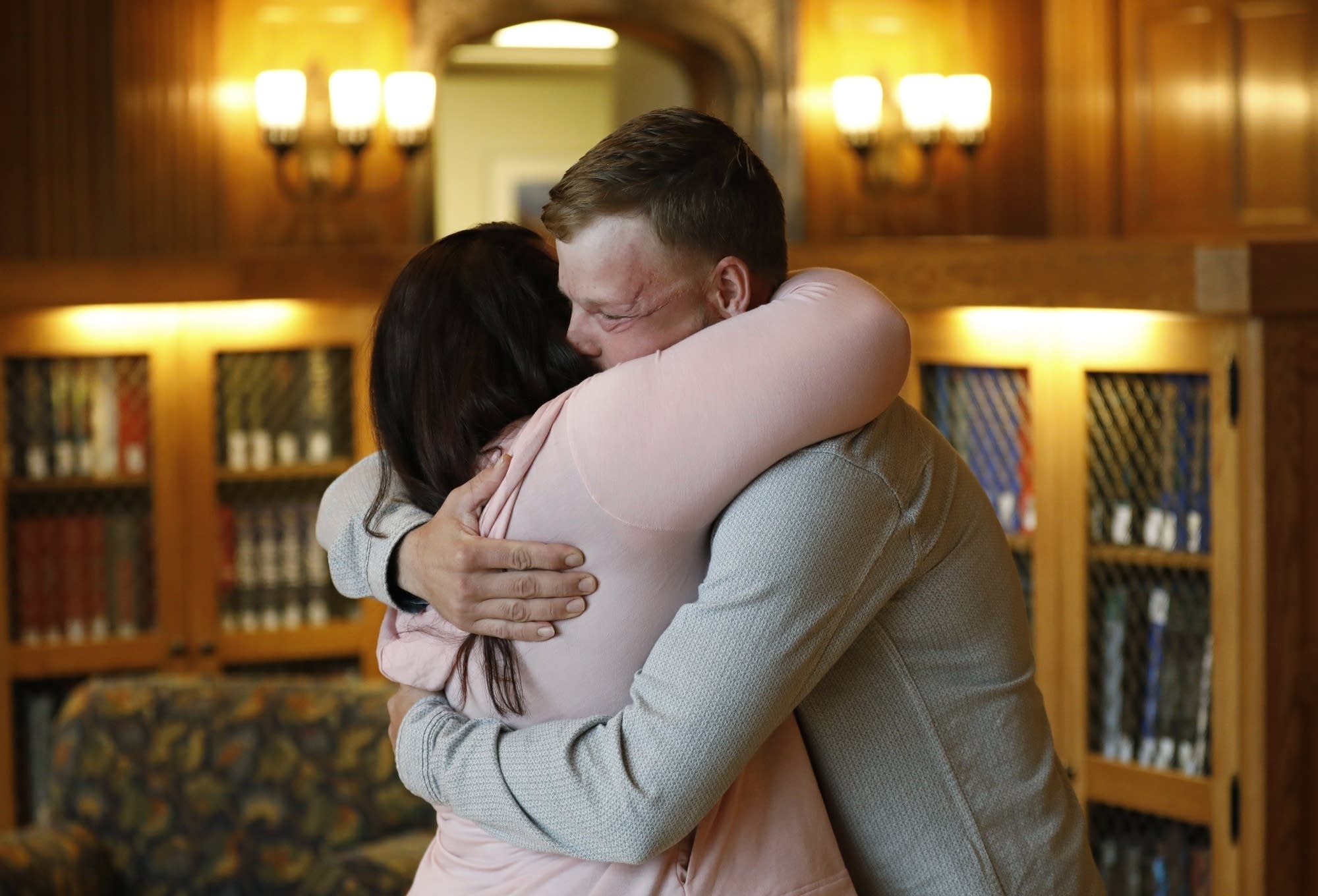 Lilly Ross, left, hugs face transplant recipient Andy Sandness.