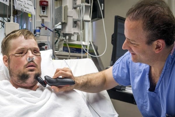 Dr. Samir Mardini shaves the face of his patient, Andy Sandness