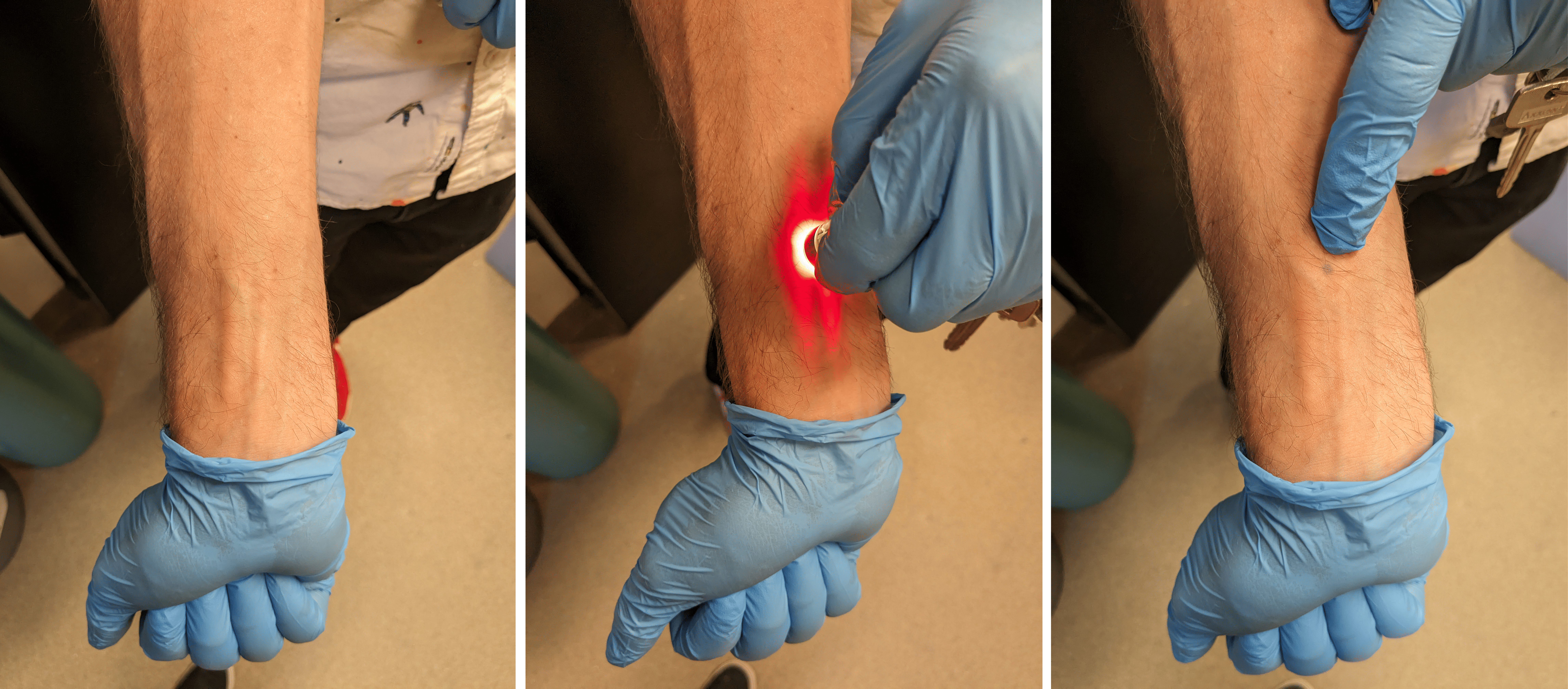 Carson Bruns demonstrates how to turn his tattoo on and off. In the first panel, his arm appears blank. In the second panel, he flashes a red UV light on his arm. In the third panel, he points to a small blue dot tattoo.