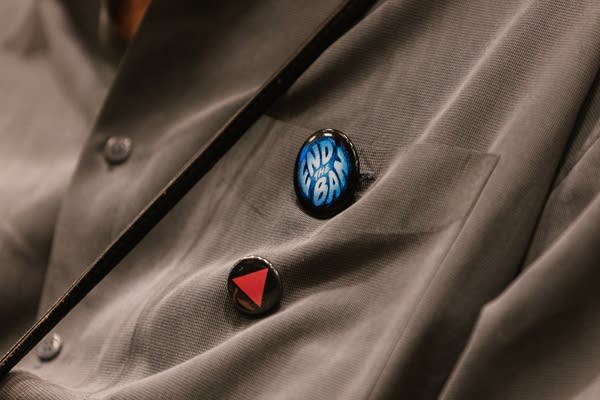 Two buttons on a shirt