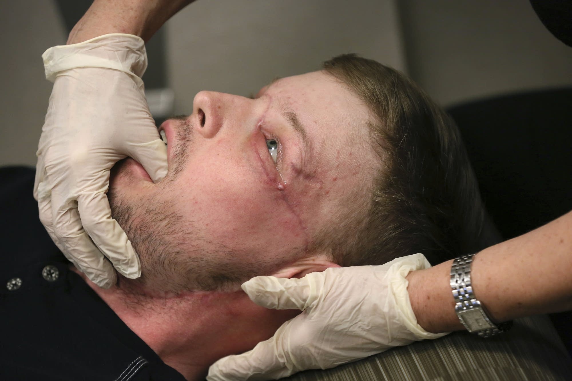 Andy Sandness has his face checked during an appointment
