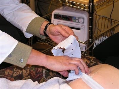 Fetal heart monitor