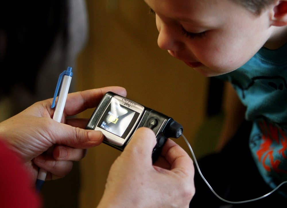 Insulin pump peek