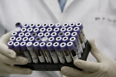 Blood samples