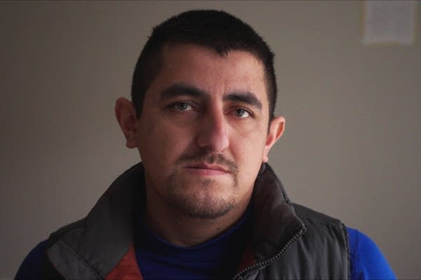 Immigrant whose skull was broken in 8 places during ICE arrest says beating was unprovoked 