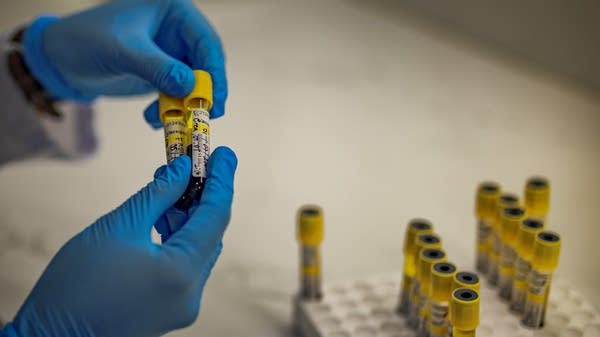 "Peer review is not really designed to catch fraud," said Dr. Elisabeth Bik. "It's designed from sort of the idea that the data that you're reviewing as a peer reviewer is real."