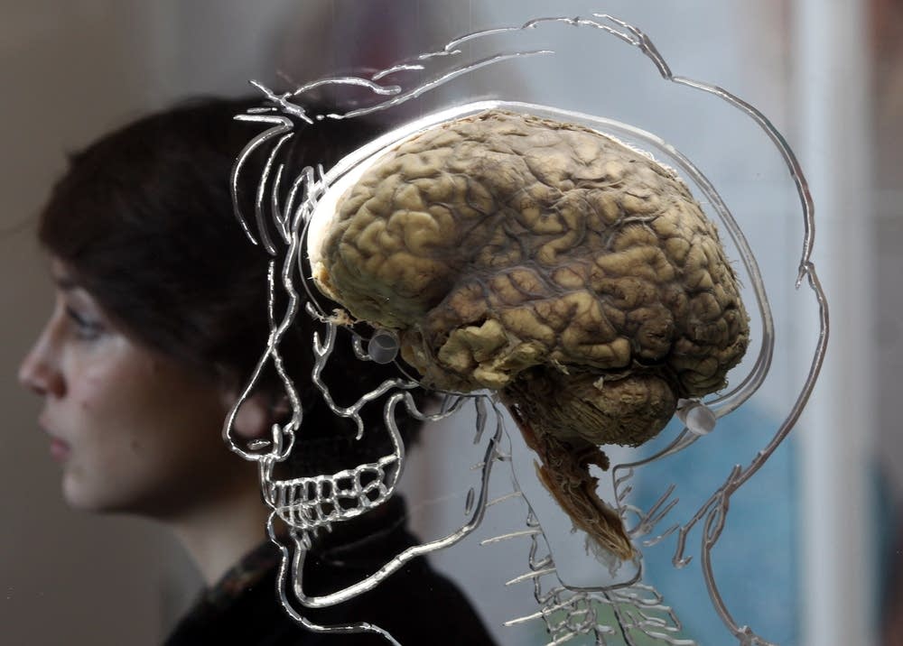 The Real Brain Exhibit at Bristol Science Centre