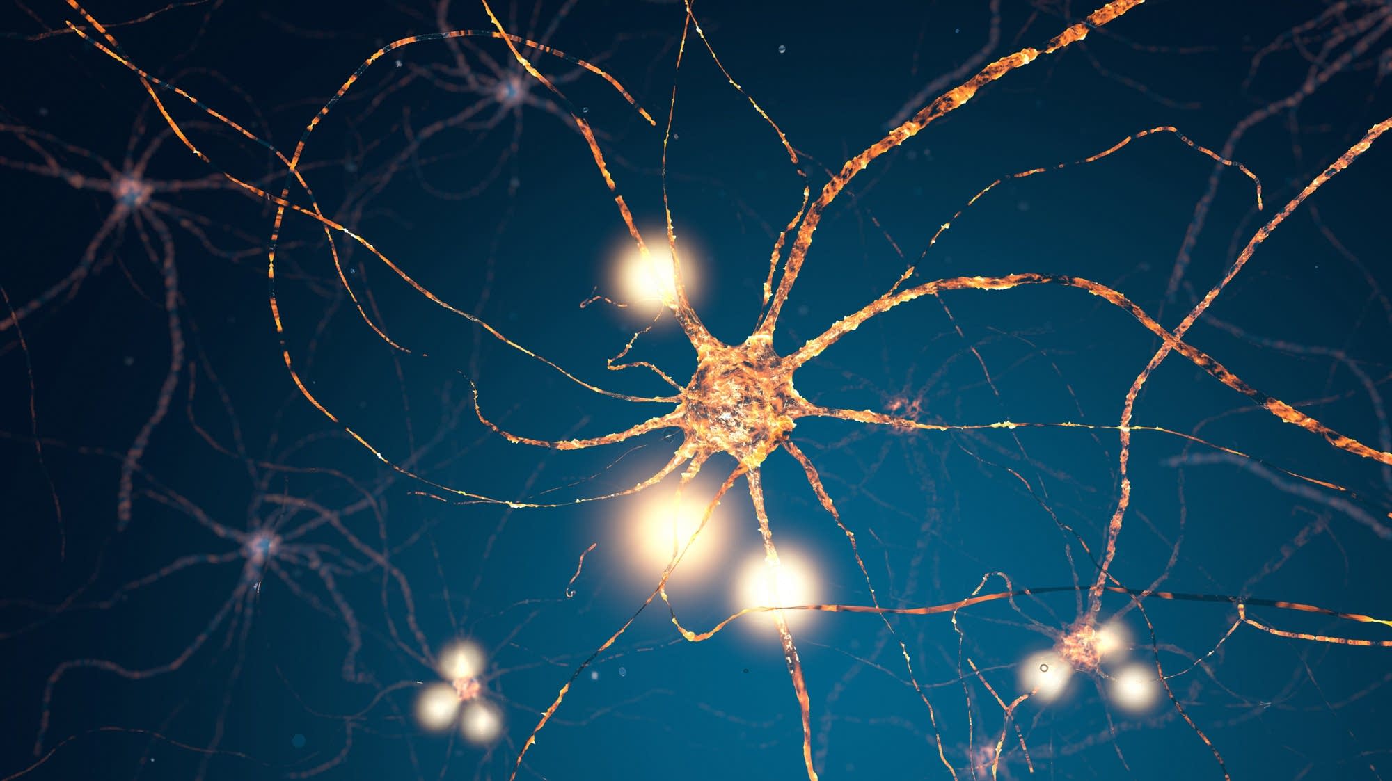 The nerve! Electricity in our bodies Brains On