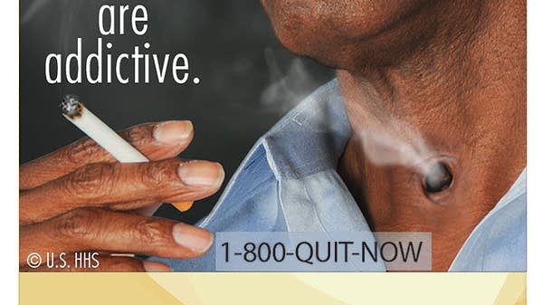 cigarette flu Smoker's Flu After Nicotine Withdrawal : Symptoms & Relief Tips