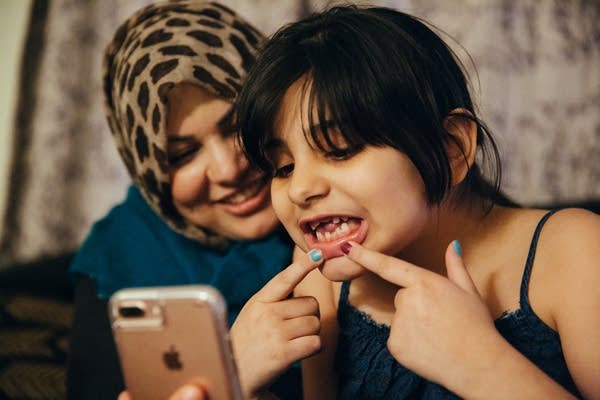 Maryam shows her father missing teeth.