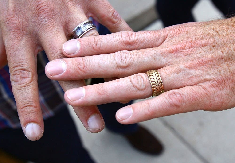 The rings