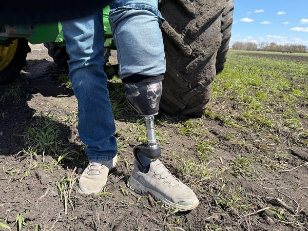 Closeup of a man's prosthetic leg, seen under blue jeans, while he stands next to a tractor.