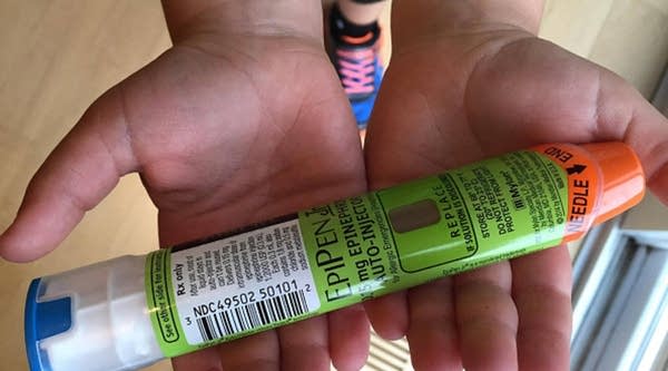 A youngster in Hudson, Wisconsin holds his Epipens which help counteract his allergic reactions. A five-fold price hike for EpiPen, which allergy sufferers use to counteract life-threatening reactions, has made Mylan the newest drugmaker to come under attack in the United States for profiteering.