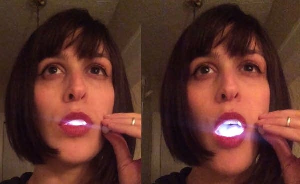 Dessa shares the story of how an electronics guru and a dentist made her mouth light up for Doomtree’s Blowout