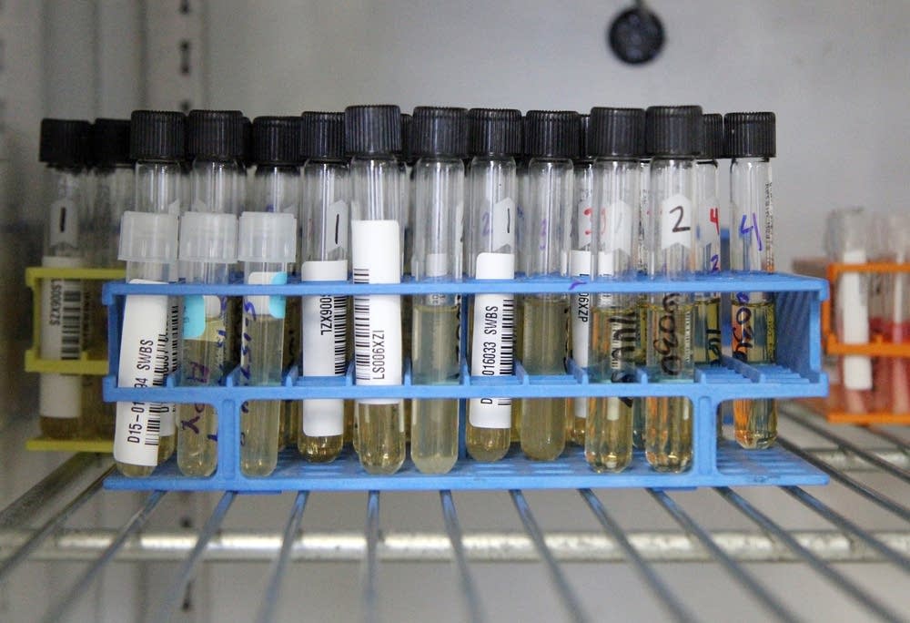 Avian influenza testing samples