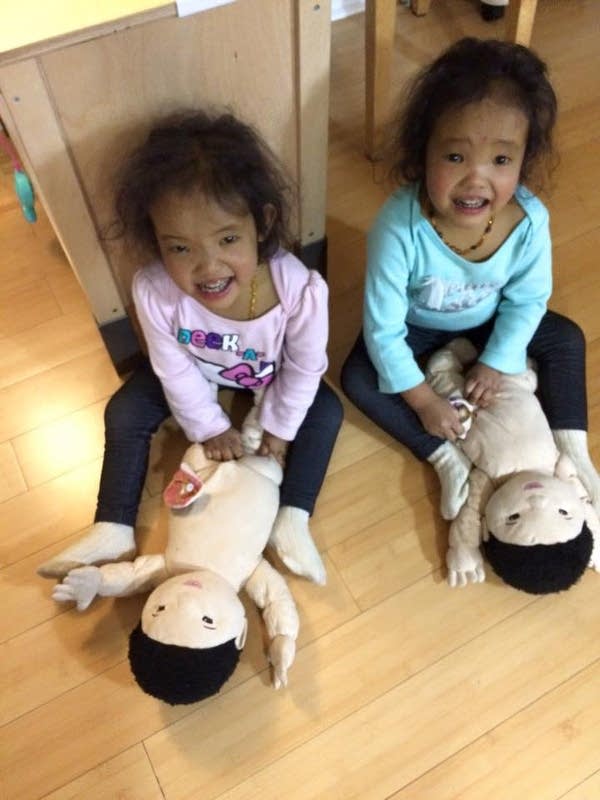 Two sick twins, but father can only donate 1 liver
