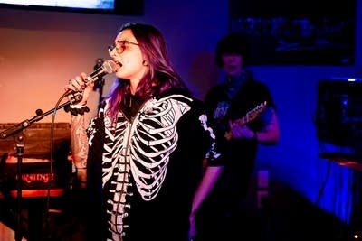 a singer and guitarist performing on stage