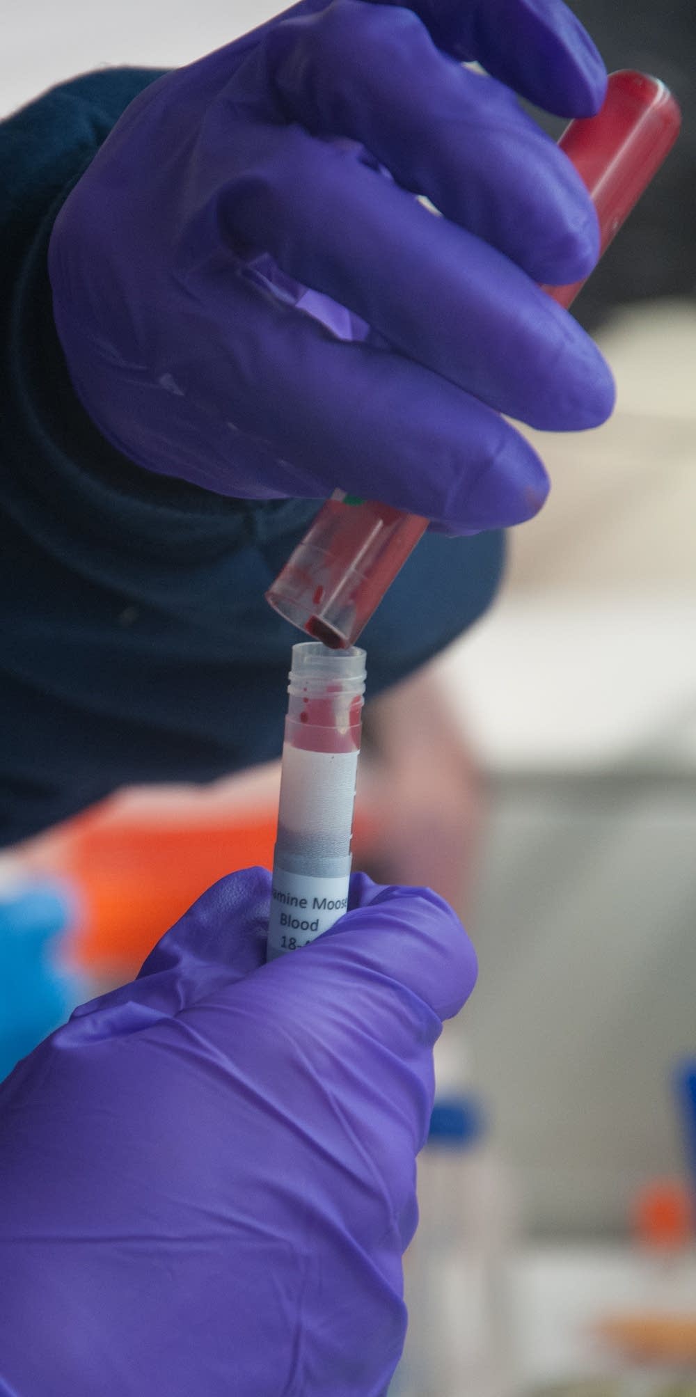 Blood sample