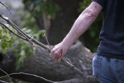 bloody arm