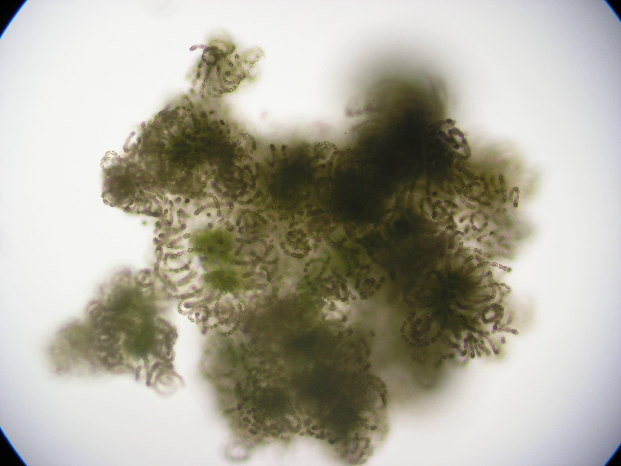 The dominant algae in the blooms are examined under a microscope.