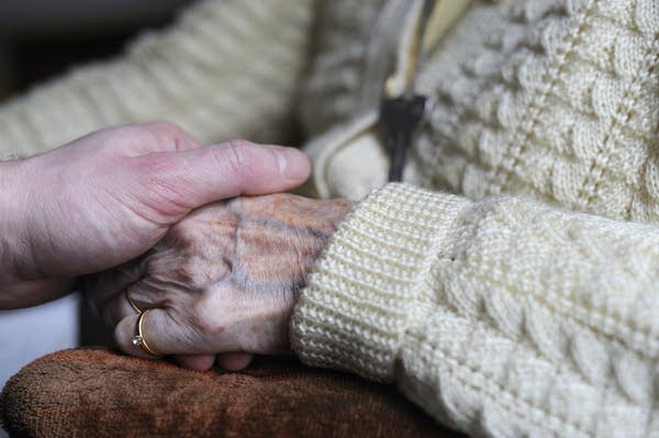 A woman, suffering from Alzheimer's