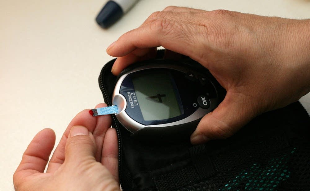 Glucose monitor