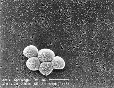 Resistant staph bacteria