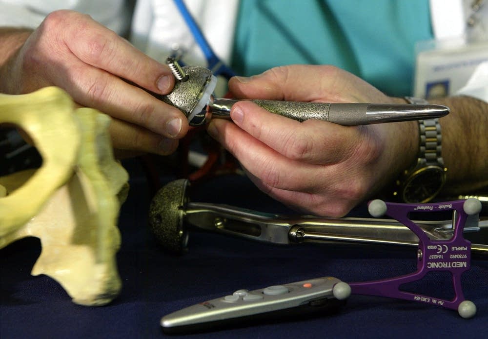 Hip replacement