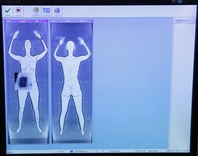 Full body scan