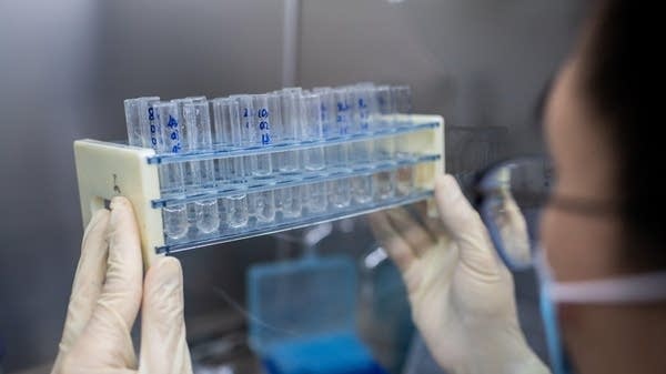 In this picture taken on April 29, 2020, an engineer works at the Quality Control Laboratory on an experimental vaccine for the COVID-19 coronavirus at the Sinovac Biotech facilities in Beijing.