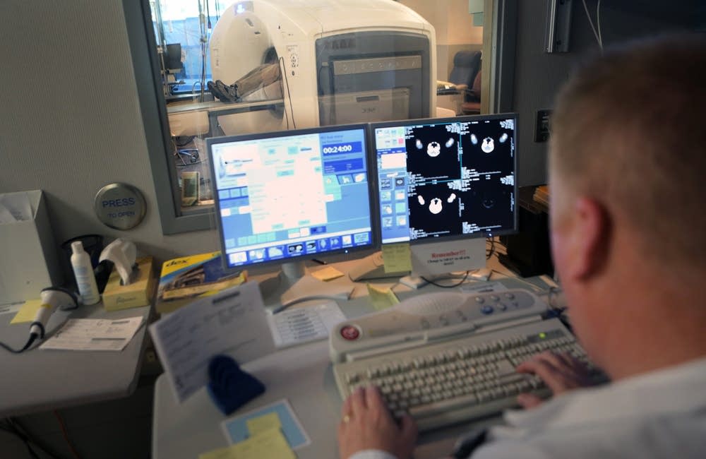 Monitoring PET scan