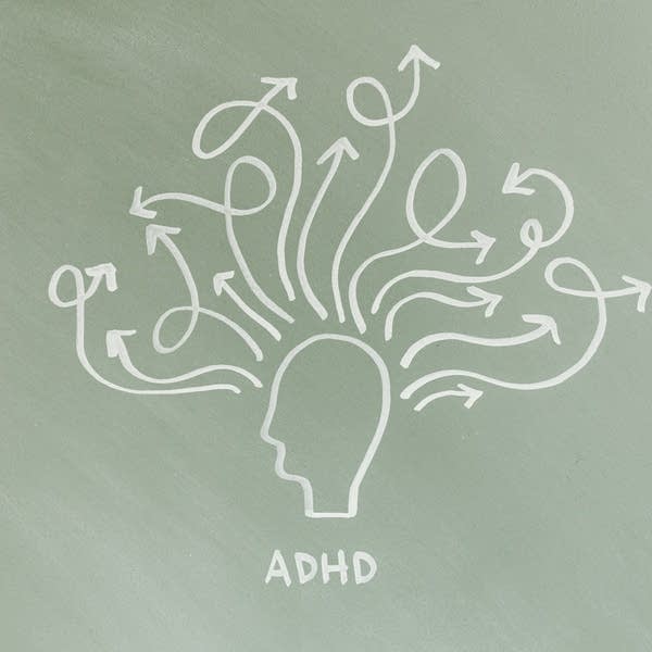 drawing of a head with words ADHD 