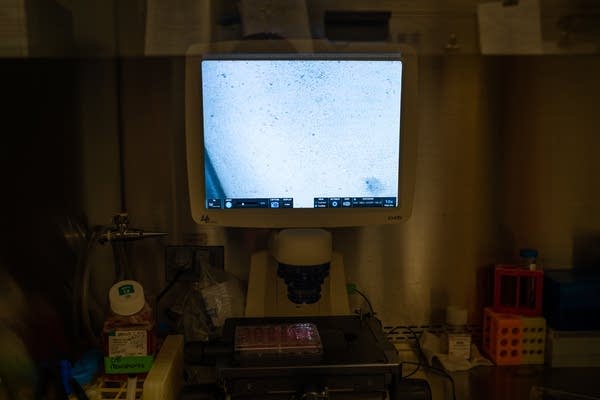 A cell is displayed on a black and white screen.