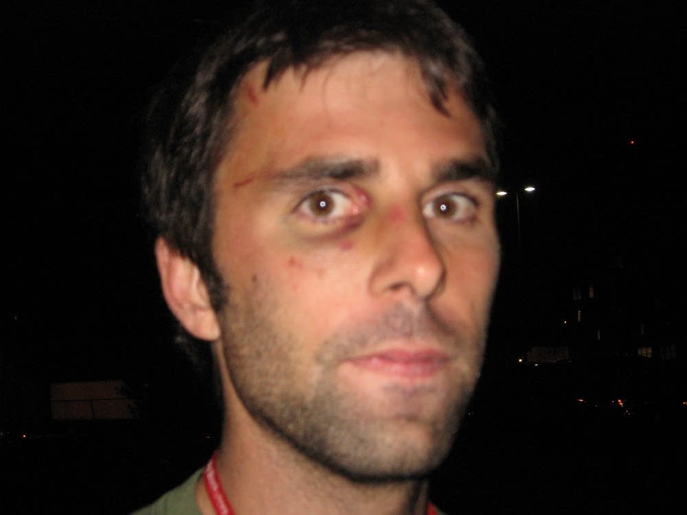 Photojournalist Nathan Weber says police beat him